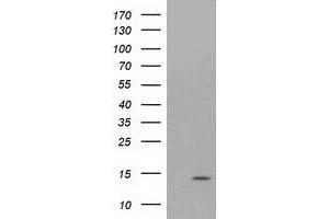 Western Blotting (WB) image for anti-ATPase, H+ Transporting, Lysosomal 14kDa, V1 Subunit F (ATP6V1F) antibody (ABIN1496778) (ATP6V1F antibody)