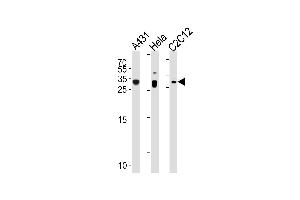 p27Kip1 Antibody (N-term S12) (ABIN1881620 and ABIN2838923) western blot analysis in A431,Hela,mouse C2C12 cell line lysates (35 μg/lane).