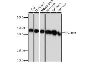 Western blot analysis of extracts of various cell lines, using PP1 beta Rabbit mAb (ABIN1679819, ABIN3018859, ABIN3018860 and ABIN7101675) at 1:1000 dilution.