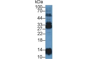 Western Blot; Sample: Human Lung lysate; Primary Ab: 1µg/ml Rabbit Anti-Human NME6 Antibody Second Ab: 0. (NME6 antibody  (AA 3-182))