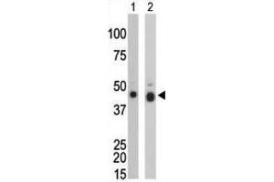Western Blotting (WB) image for anti-Creatine Kinase, Brain (CKB) antibody (ABIN3002965) (CKB antibody)