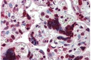 Human Placenta: Formalin-Fixed, Paraffin-Embedded (FFPE) (HMGA1 antibody  (AA 9-21))
