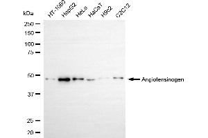 Western blotting analysis using angiotensinogen antibody (ABIN7797608).