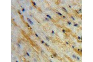Used in DAB staining on fromalin fixed paraffin-embedded Heart tissue (Corin antibody  (AA 521-637))