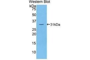 Detection of Recombinant Thyroglobulin, Human using Polyclonal Antibody to Thyroglobulin (TG) (Thyroglobulin antibody  (AA 2083-2333))