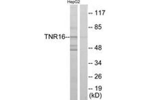 Western blot analysis of extracts from HepG2 cells, using TNR16 Antibody. (NGFR antibody  (AA 121-170))