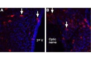 Expression of Angiotensin II receptor type-2 in rat brain - Immunohistochemical staining of rat brain sections using Anti-Angiotensin Receptor Type-2 (extracellular) Antibody (ABIN7042925, ABIN7043902 and ABIN7043903). (Angiotensin II Type 2 Receptor antibody  (Extracellular, N-Term))