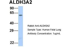 Host:  Rabbit  Target Name:  ALDH3A2  Sample Type:  Human Fetal Lung  Antibody Dilution:  1. (ALDH3A2 antibody  (Middle Region))