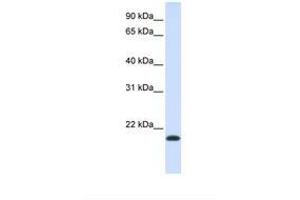 Image no. 1 for anti-Na+/K+ Transporting ATPase Interacting 1 (NKAIN1) (AA 118-167) antibody (ABIN6738628) (NKAIN1 antibody  (AA 118-167))