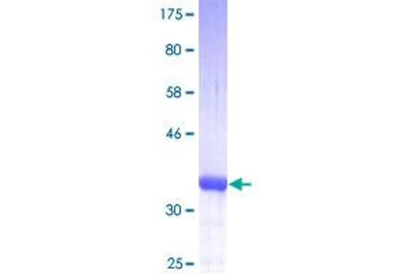 S100A10 Protein (AA 1-97) (GST tag)