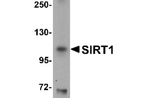 Western Blotting (WB) image for anti-Sirtuin 1 (SIRT1) (N-Term) antibody (ABIN1031567) (SIRT1 antibody  (N-Term))