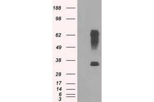 Western Blotting (WB) image for anti-Ring Finger Protein 144B (RNF144B) (AA 1-256) antibody (ABIN1490651) (RNF144B antibody  (AA 1-256))