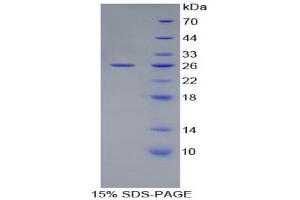 SDS-PAGE (SDS) image for Activating Transcription Factor 4 (Tax-Responsive Enhancer Element B67) (ATF4) (AA 125-329) protein (His tag) (ABIN1879227) (ATF4 Protein (AA 125-329) (His tag))