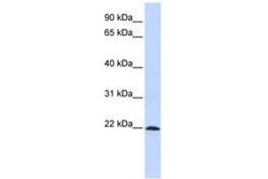 Image no. 1 for anti-Zinc Finger Protein 581 (ZNF581) (AA 36-85) antibody (ABIN6740516) (ZNF581 antibody  (AA 36-85))