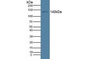 Detection of CTXI in Rat Stomach Tissue using Monoclonal Antibody to Cross Linked C-Telopeptide Of Type I Collagen (CTXI) (CTX-I antibody)