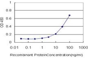 Detection limit for recombinant GST tagged CRYBB1 is approximately 3ng/ml as a capture antibody. (CRYBB1 antibody  (AA 37-137))