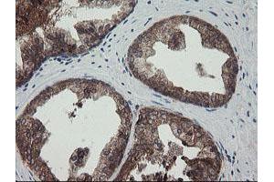 Image no. 5 for anti-Tumor Protein D52-Like 3 (TPD52L3) antibody (ABIN1501476)