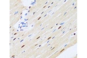 Immunohistochemistry of paraffin-embedded Rat heart using MTA3 Polyclonal Antibody at dilution of 1:100 (40x lens).