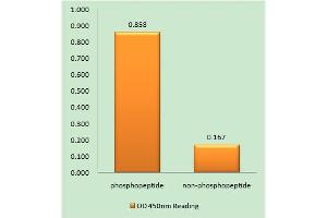Immunohistochemistry analysis of paraffin-embedded human brain tissue using EPHA3/4/5 (Phospho-Tyr779/833) antibody. (EPH Receptor A3 antibody  (pTyr779, pTyr833))