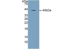 Detection of Recombinant ALPL, Human using Polyclonal Antibody to Alkaline Phosphatase, Tissue-nonspecific (ALPL) (ALPL antibody  (AA 18-335))