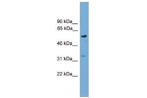 RSAD1 antibody used at 0. (RSAD1 antibody  (Middle Region))