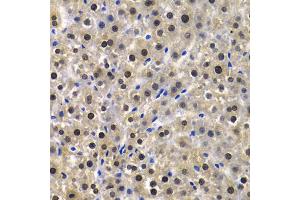 Immunohistochemistry of paraffin-embedded rat liver using KPNA4 Antibody (ABIN5971058) at dilution of 1/100 (40x lens). (KPNA4 antibody)