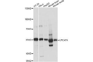 Western blot analysis of extracts of various cell lines, using LPCAT4 antibody (ABIN6292470) at 1:3000 dilution.