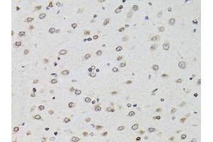 Immunohistochemistry of paraffin-embedded mouse brain using TMPO Antibody (ABIN1875122) at dilution of 1:100 (40x lens). (Thymopoietin antibody)