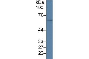 Detection of GDF5 in Mouse Cerebrum lysate using Polyclonal Antibody to Growth Differentiation Factor 5 (GDF5) (GDF5 antibody  (AA 358-495))