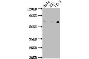 Western Blot Positive WB detected in: Hela whole cell lysate, 293 whole cell lysate, PC-3 whole cell lysate All lanes: EXOC7 antibody at 1:2000 Secondary Goat polyclonal to rabbit IgG at 1/50000 dilution Predicted band size: 84, 79, 75, 33, 78, 81 kDa Observed band size: 75 kDa (EXOC7 antibody  (AA 521-735))