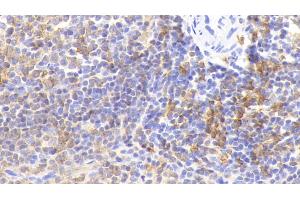 Detection of HLA-DRA in Rabbit Spleen Tissue using Polyclonal Antibody to HLA Class II Histocompatibility Antigen, DR Alpha Chain (HLA-DRA) (HLA-DRA antibody  (AA 26-221))