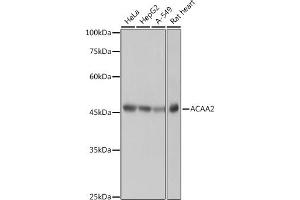 Western blot analysis of extracts of various cell lines, using  antibody (ABIN7265367) at 1:1000 dilution. (ACAA2 antibody)