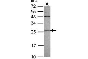 WB Image Sample (30 ug of whole cell lysate) A: 293T 12% SDS PAGE GST A4 antibody antibody diluted at 1:1000 (GSTA4 antibody)