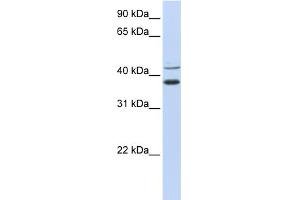 WB Suggested Anti-MKRN2 Antibody Titration:  0. (MKRN2 antibody  (N-Term))