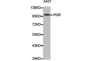 Western Blotting (WB) image for anti-Progesterone Receptor (PGR) antibody (ABIN1874114) (Progesterone Receptor antibody)