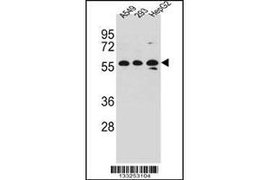 Western blot analysis in A549,293,HepG2 cell line lysates (35ug/lane). (TRIM4 antibody  (N-Term))