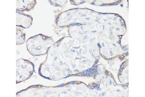 Immunohistochemistry of paraffin-embedded Human placenta using CLUH Polyclonal Antibody at dilution of 1:100 (40x lens). (CLUH antibody)