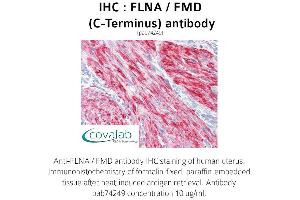Image no. 1 for anti-Filamin A, alpha (FLNA) antibody (ABIN1734376) (Filamin A antibody)