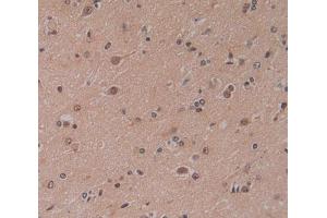 Used in DAB staining on fromalin fixed paraffin- embedded brain tissue (CBY1/PGEA1 antibody  (AA 12-115))
