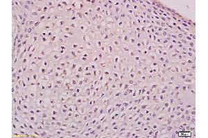 Formalin-fixed and paraffin embedded mouse embryo tissue labeled with Anti Apg12 Polyclonal Antibody,Unconjugated (ABIN752518) at 1:200 followed by conjugation to the secondary antibody and DAB staining. (ATG12 antibody  (AA 101-187))