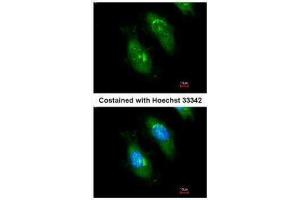 ICC/IF Image Immunofluorescence analysis of methanol-fixed HeLa, using SMN1, antibody at 1:200 dilution. (SMN1 antibody)
