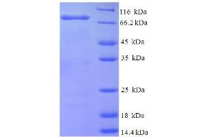 SDS-PAGE (SDS) image for N-Deacetylase/N-Sulfotransferase (Heparan Glucosaminyl) 1 (NDST1) (AA 40-556), (Isoform 2) protein (His-SUMO Tag) (ABIN5709995) (NDST1 Protein (AA 40-556, Isoform 2) (His-SUMO Tag))