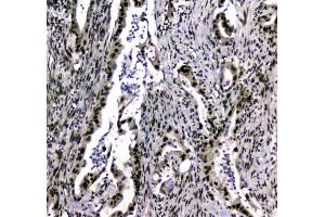 IHC analysis of SAE2/UBA2 using anti-SAE2/UBA2 antibody .