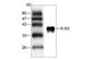 Image no. 1 for anti-Japanese Encephalitis Virus (JEV) (AA 291-402) antibody (ABIN791587) (Japanese Encephalitis Virus (JEV) (AA 291-402) antibody)