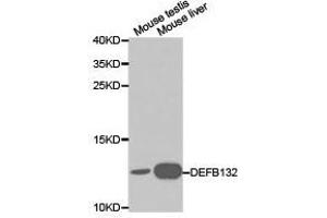 Western Blotting (WB) image for anti-Defensin, beta 132 (DEFB132) antibody (ABIN1872246) (DEFB132 antibody)