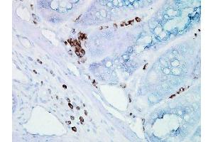 Immunohistochemistry analysis using Mouse Anti-Hsp70 Monoclonal Antibody, Clone BB70 . (HSP70/HSC70 antibody  (PE))