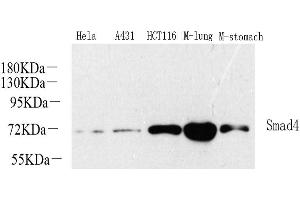 Western Blot analysis of various samples using SMAD4 Polyclonal Antibody at dilution of 1:1000. (SMAD4 antibody)