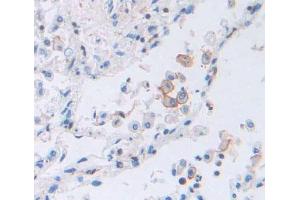 Used in DAB staining on fromalin fixed paraffin- embedded lung tissue (TAP2 antibody  (AA 468-686))