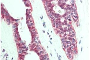 PTPLA antibody  (AA 37-66)