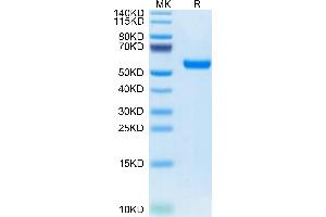 Mouse RNF43 on Tris-Bis PAGE under reduced condition. (RNF34 Protein (AA 24-197) (Fc Tag))